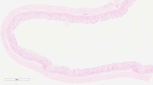 Pincha el enlace para ver detalle de la mucosa y submucosa